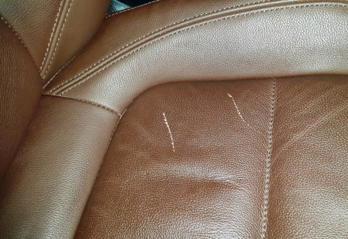 Skin scratches Skin scratches